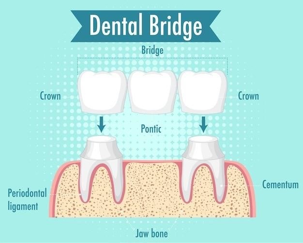 denture gum shade guide